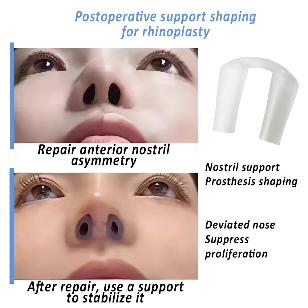 بعد العملية الجراحية الأنف دعم - مراجعة Anti Snore Contour Pillow وسعره
